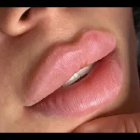 جشنواره لیزر موهای زائد