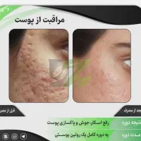 پوست ومو|آرایشی، بهداشتی، درمانی|قم, قم نو|دیوار