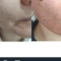 آموزش و خدمات پلکسر(پلاسما)