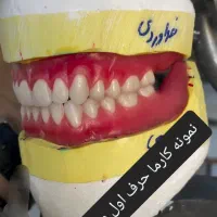 دندانسازی وساخت دندان بدون کام