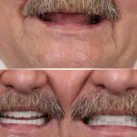 دندانپزشکی سرو پنجاه درصد تخفیف اقساطی