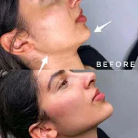 استخدام کلینیک جراحی( پرستارمشاور)|استخدام درمانی، زیبایی، بهداشتی|تهران, قیطریه|دیوار