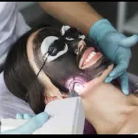 کربن تراپی صورت و بدن