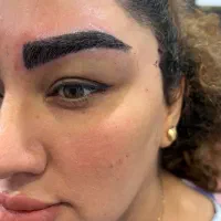 کاشت ابرو و مو تخفیف ویژه