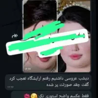 کرم روشن کننده خارجی مکمل چاقی صورت تضمینی|آرایشی، بهداشتی، درمانی|بندر ماهشهر, |دیوار