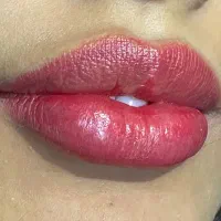 کلینیک پوست ومومایا|خدمات آرایشگری و زیبایی|کرج, شهرک اوج|دیوار