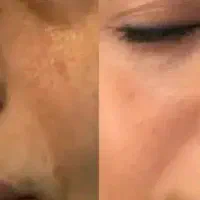 کرم  ضد لک