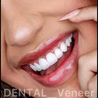 اقساط استثنایی دندانپزشکی همه امور دندان پزشکی|خدمات آرایشگری و زیبایی|اصفهان, دشتستان|دیوار
