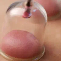 ماساژ و حجامت و بادکش گرم زالو درمانی