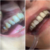 خدمات دندانپزشکی|خدمات آرایشگری و زیبایی|رشت, گلسار|دیوار