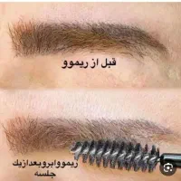 پاک‌کردن‌تتوصورت