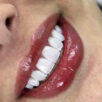 انجام تمامی خدمات دندانپزشکی با اقساط ۱۸ ماهه