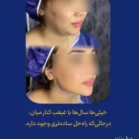 مرکز تخصصی ساکشن غبغب((دائمی)) یاسوج