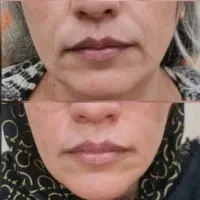 غول ضد لک فرانسوی