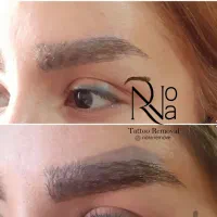 پاک کردن تتو با لیزر/ریموو ابرو/کربن تراپی(پزشک)|خدمات آرایشگری و زیبایی|مشهد, فردوسی|دیوار