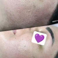 پاکسازی صورت برای جمعه با ۶۰۰ تومان
