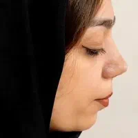 عمل بینی|خدمات آرایشگری و زیبایی|خرم‌آباد, |دیوار