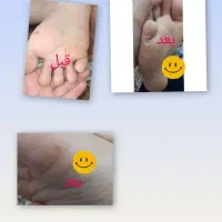 نانووگان نقره نرم کننده وترمیم کننده|آرایشی، بهداشتی، درمانی|مرودشت, فاز دوم شهرک فرهنگیان|دیوار