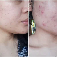 حجامت با لوازم کاملاً بهداشت و یکبار مصرف در مرکز|خدمات آرایشگری و زیبایی|کرمانشاه, |دیوار