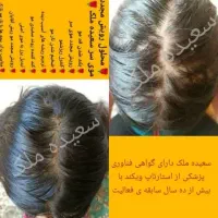 محلول گیاهی و. درمانی رویش و رشد مو و ریش