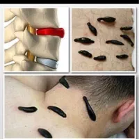 ط ب سوزنی حجامت زالو وط ب ماساژ فشاری کایروپراتیک