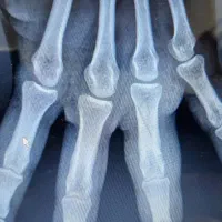 شکسته بندی کایروپراکتیک حجامت فصد خون|خدمات آرایشگری و زیبایی|تهران, حشمتیه|دیوار