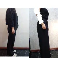 لاغری موضعی با کاهش سایز 10الی 20