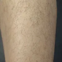 اپیلاسیون(مومک زینب تیموری)