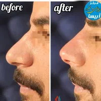 تخفیف ویژه خدمات پوست و مو به مناسبت روز  پزشک|خدمات آرایشگری و زیبایی|کرمانشاه, |دیوار