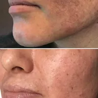 پاکسازی و جوانسازی پوست (فیشیال)|خدمات آرایشگری و زیبایی|تهران, مدائن|دیوار