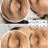 آموزش فیشال و پاکسازی پوست + تخفیف و پرداخت ۲ قسطی|خدمات آموزشی|شیراز, فرهنگ شهر|دیوار