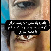 جراحی درمطب توسط پزشک جراح درخرم اباد|خدمات آرایشگری و زیبایی|دورود, |دیوار