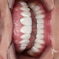 دندانپزشکی تخصصی ایمپلنت،لمینت،روکش دندان،ارتودنسی|خدمات آرایشگری و زیبایی|تبریز, |دیوار