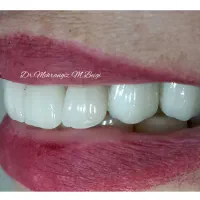 دندانپزشکی زیبایی و لمینت|خدمات آرایشگری و زیبایی|تهران, سلیمانی|دیوار