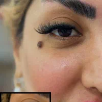 کاشت مژه و لیفت ابرو