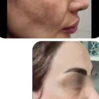 کرم معجزه vip سفیدکننده،از بین برنده لک،کک و مک|آرایشی، بهداشتی، درمانی|مشهد, شهید هاشمی نژاد|دیوار