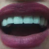 دندانپزشکی و دندانسازی مولر