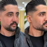 ژل و بوتاکس کاشت ابرو قسطی|خدمات آرایشگری و زیبایی|یاسوج, |دیوار