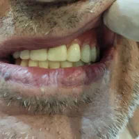 دندانسازی|خدمات آرایشگری و زیبایی|شیراز, امام حسین|دیوار