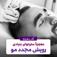 رویش مجدد موهای ریخته شده با سلولهای بنیادی