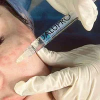خدمات تخصصی ژل بوتاکس لیزر در کلینیک پزشکی|خدمات آرایشگری و زیبایی|شیراز, ارم|دیوار