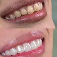 به لبخندخود اهمیت دهید