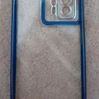 قاب گوشی شیایومی