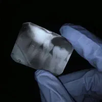 استخدام دستیار دندانپزشک