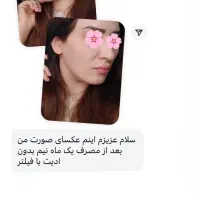 پررضایت ترین کرم بازار|آرایشی، بهداشتی، درمانی|اهواز, مجاهد|دیوار