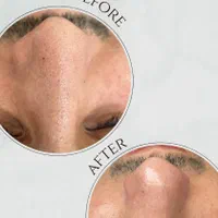 مدل فیشال صورت بدن خانم اقا دونفره یا تک نفره|خدمات آرایشگری و زیبایی|مشهد, وکیل‌آباد|دیوار