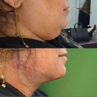کلینیک زیبایی الارز پاداد ( کلینیک دکتر فتحی)|خدمات آرایشگری و زیبایی|اهواز, پادادشهر|دیوار