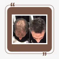 تو فقط دنبال نتیجه باش