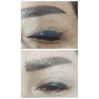 پاک کردن تتو(ریموو تتو)|خدمات آرایشگری و زیبایی|کرمانشاه, |دیوار