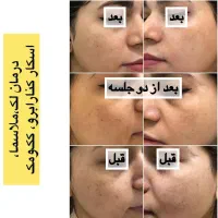 اموزش فیشال|خدمات آموزشی|مشهد, دانشجو|دیوار